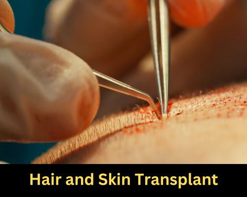 Skin and Hair Transplant - Vizox Clinique