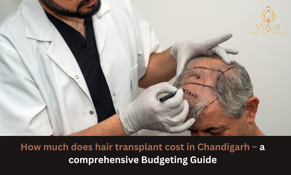 hair-transplant-in-Chandigarh