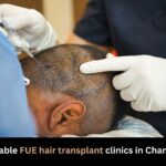 Affordable FUE hair transplant clinics in Chandigarh