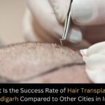 What Is the Success Rate of Hair Transplant in Chandigarh Compared to Other Cities in India?