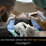DHI hair treatment